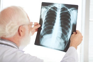 Em 2022, aumentaram principalmente as mortes por doenças do aparelho respiratório